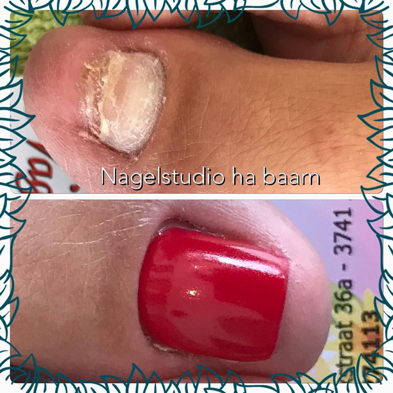 Nagelherstelbehandeling bij Nagelstudio Ha in Baarn